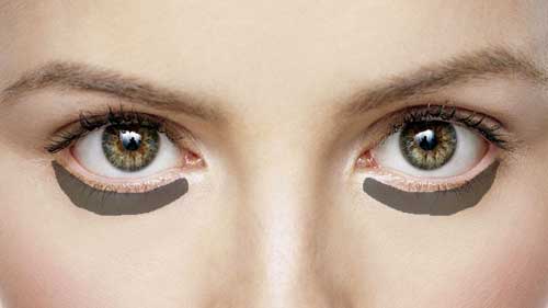 Home Remedies To Get Rid Of Dark Circles