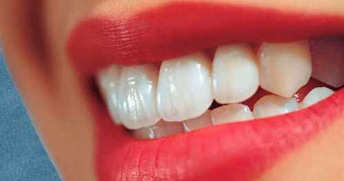 Teeth Whitening Home Remedies